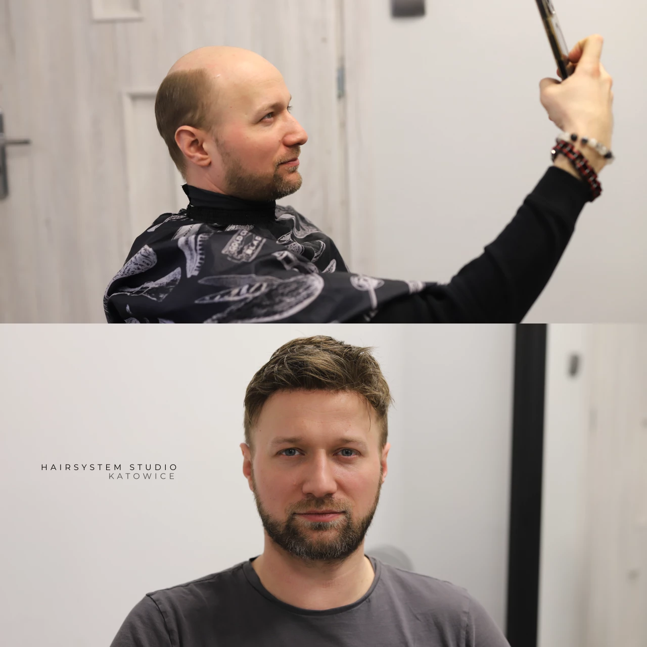 system włosów